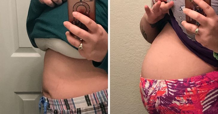 Mulher mostrando a barriga antes e depois de sete dias de protocolo